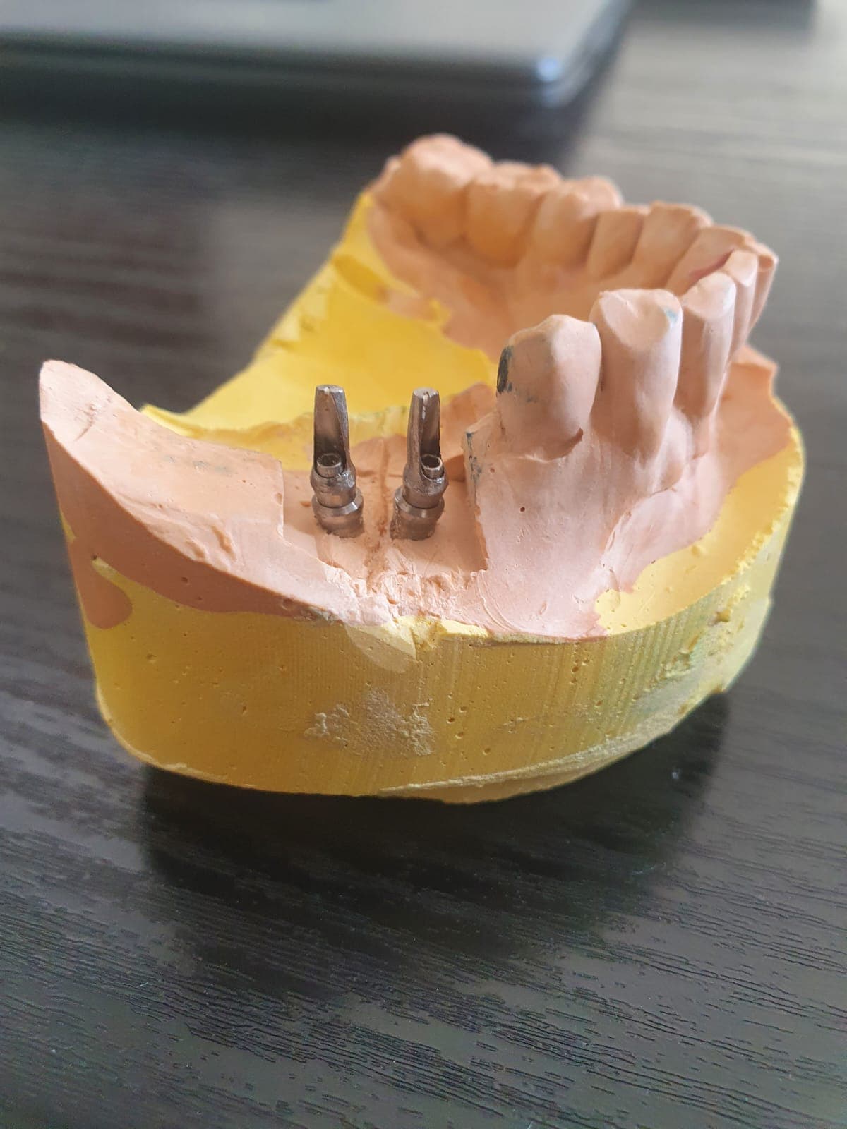 Transformation dentaire — cas 8